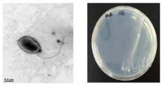 호산성 Bradyrhizobium 속 발굴종 B8의 전자현미경과 배양체 사진