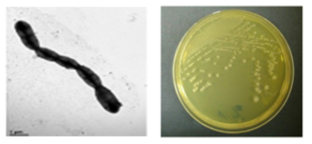 멸종위기 동물 장내 Vagococcus 속 M7T301의 전자현미경과 배양체 사진