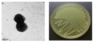 멸종위기 동물 장내 Streptococcus 속 M1T307의 전자현미경과 배양체 사진