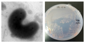 방사선 내성 Larkinella 속 발굴종 SR1-5-4의 전자현미경과 배양체 사진