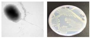방사선 내성 Pantoea 속 발굴종 15J17K의 전자현미경과 배양체 사진