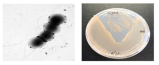 방사선 내성 Pseudokineococcus 속 발굴종 15J13-6의 전자현미경과 배양체 사진
