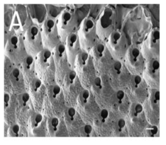 태충류 신종 A. Plesiocleidochasma clandestina sp. nov. Scale bar. A: 100㎛