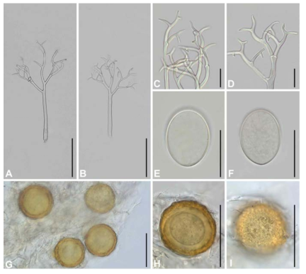 Morphological characteristics of Peronospora casparyi sp. nov. parasitic on Pseudostellaria davidii. (A-B) Conidiophores, (C-D) Ultimate branchlets, (E-F) Conidia, (G-I) Resting organs. Scale bars: 100 μm for conidiophores, 20 μm for ultimate branchlets and conidia, and 40 μm for resting organs