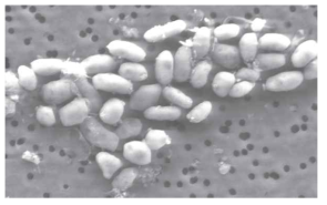 비소 함유 미생물(GFAJ-1)의 전자현미경 사진 (SEM)