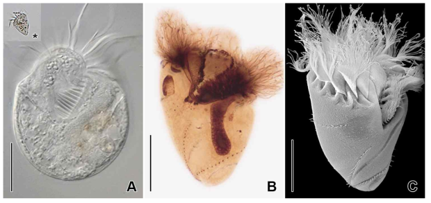 Novistrombidium apsheronicum in vivo (A), protargol impregnated and SEM specimen (B). A. Squeezed individual in vivo, asterisk (*) indicates the original body shape in vivo. B, C. Ventral view to show girdle kinety and ventral kinety. Scale bars: A = 30 μm, B, C = 20 μm