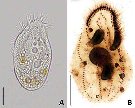 Paraholosticha muscicola in vivo (A) and protargol impregnated specimen (B). A. Typical individual in vivo. B. Ventral view to show oral and ventral somatic ciliature. Scale bars: A, B = 30 μm