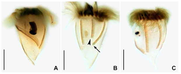 Pelagostrobilidium conicum protargol impregnated specimens. A–C. Individuals that show the arrangements of somatic kineties 1–6 (arrow indicates somatic kinety 1, arrowhead denotes somatic kinety 2 in B). Scale bars: 10 μm