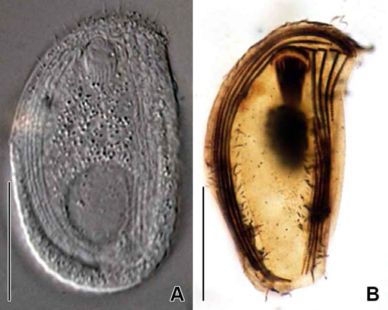 Pseudochilodonopsis fluviatilis in vivo (A) and protargol impregnated specimen (B). A. Typical individual in vivo. B. Ventral view to show oral and ventral somatic ciliature. Scale bars: A, B = 30 μm
