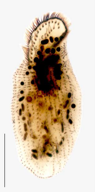 Pseudourostyla subtropica protargol impregnated specimen. Scale bar: 100 μm