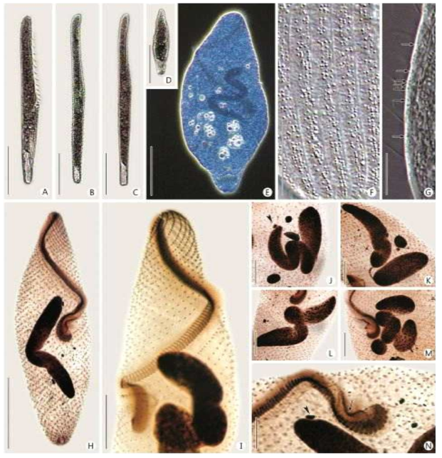 (A–N) Photomicrographs of Spirostomum yagiui from life (A–G) and after protargol impregnation (H–N). A–C: Lateral side views to show the different ratios of oral length to body length. D: Lateral side view of a contracted cell. E: Rod-shaped macronucleus in contracted body. F: Arrangement of cortical granules. G: Lateral side view of cortical granules (arrows). H: Ventral side view of a typical impregnated individual to show the torsional somatic kineties, adoral zone of membranelles, and the rod-shaped macronucleus. I: Detailed structure of adoral zone of membranelles and anterior somatic kineties. J–M: Various shapes of the macronucleus, arrowhead indicates the micronucleus. N: Arrow denotes the paroral membrane, arrowhead marks the lenticular micronucleus