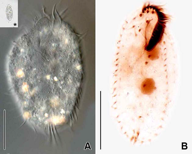 Sterkiella tricirrata in vivo (A) and protargol impregnated specimen (B). A. Squeezed individual in vivo, asterisk (*) indicates the original body shape in vivo. B. Ventral view to show oral and somatic ciliature. Scale bars: A, B = 30 μm