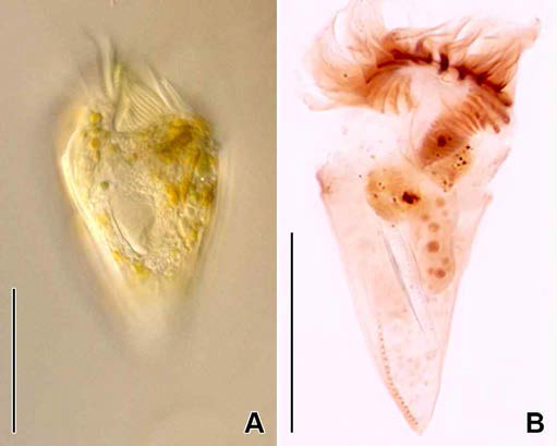 Strombidium conicum in vivo (A) and protargol impregnated specimen (B). A. Typical individual in vivo. B. Ventral view to show ventral kinety. Scale bars: A, B = 30 μm