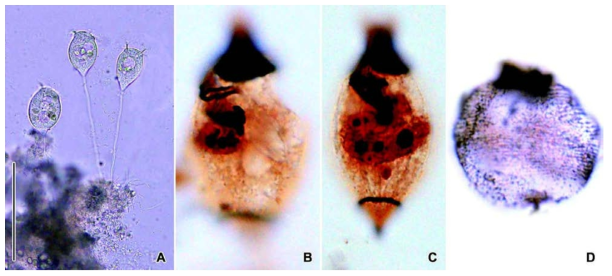 Vorticella infusionum in vivo (A), protargol (B, C) and silver nitrate impregnated specimens (D). A. Zooid shapes in vivo. B. Oral ciliature. C. Horizontal C-shaped macronucleus. D. Silverline system. Scale bar: 100 μm
