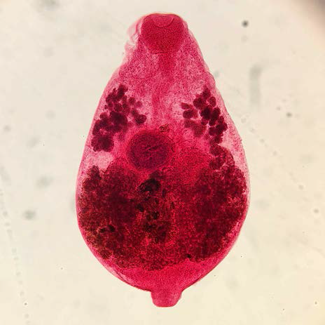 Acetocarmine stained specimen of Antorchis chaetodontis