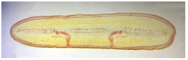 Cross section of larval worm of Digramma interrupta