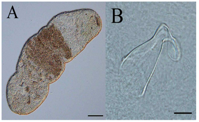 A. Live individual. B. Sclerotic stylet. (Scale bar. A= 100μm, B= 10μm)