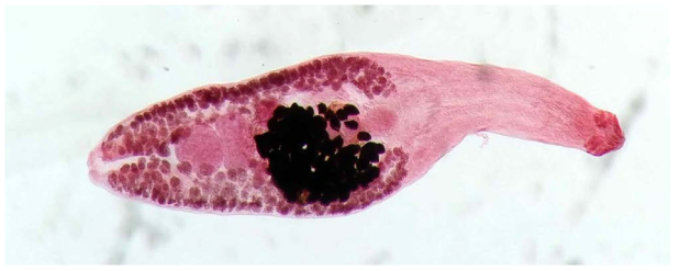 Acetacarmine stained specimen of Petasiger exaretus