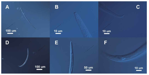 Aphelenchoides sp. n.. A. Female. whole body. 100X; B. Female. head and esophagus region. 400X; C. Female. tail region. 1000X; D. Male. whole body. 100X; E. Male. head and esophagus region. 400X; F. Male. spicule. 1000X