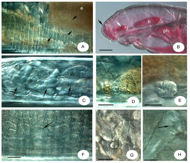 Micrographs of Achaeta koreana sp. n