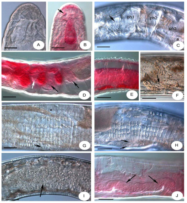 Micrographs of Achaeta macroampullacea sp. n