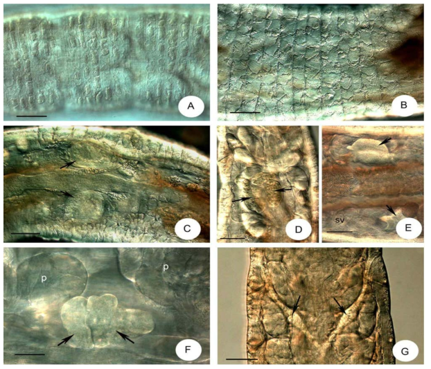 Micrographs of Bryodrilus hallasanensis sp. n