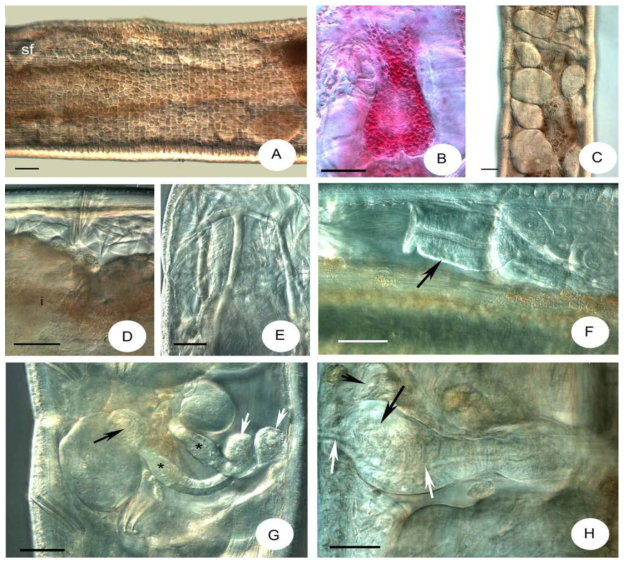 Micrographs of Chamaedrilus baekrokdamensis sp. n