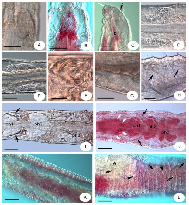 Micrographs of Enchytronia seongpanakiensis sp. n