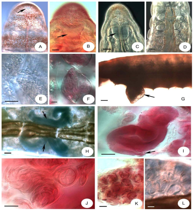 Micrographs of Mesenchytraeus jungsaihoi sp. n
