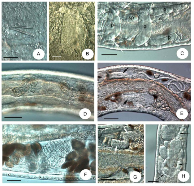 Micrographs of Xetadrilus jejuensi sp. n