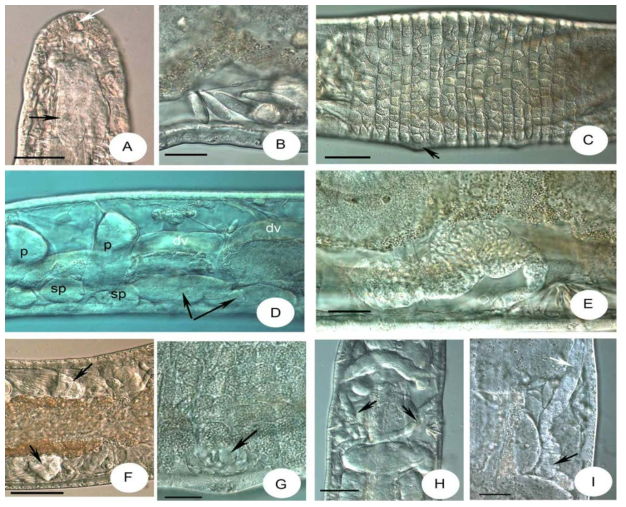 M.icrographs of Xetadrilus aphanoides sp. n