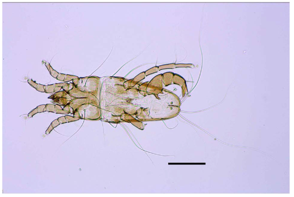 Longipedia n. sp. Scale bar: 0.2 mm