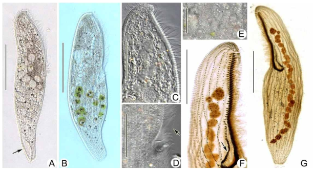 (A–G) Photomicrographs of Anigsteinia paraclarissima spec. nov. from life (A–E) and after protargol staining (F, G). A: General view of a typical individual, arrow shows lacunar contractile vacuole system. B: Right view of fat individual filled with numerous green food vacuoles. C: anterior region of cell showing the massed inclusions, including shining droplets and food vacuoles. D: Posterior portion of buccal field, arrow indicates paroral membrane. E: The arrangement of colorless cortical granules. F: Anterior of cell (right view), arrow shows paroral membrane. G: Left view of a typical individual, showing the general infraciliature and macronuclear nodules. Scale bars 100 μm (A, B, G), 50 μm (C, D, F), 25 μm (E)