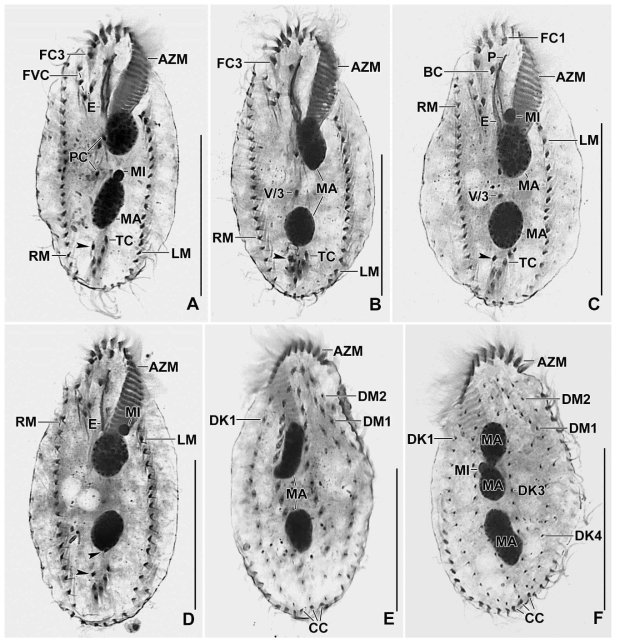 Photomicrographs of Metasterkiella koreana after protargol impregnation. A. Ventral view of the holotype specimen; B-F. Paratype specimens, showing body shape, nuclear apparatus, and ciliature on the ventral (B-D) and dorsal surface (E, F). A rare specimen (F) with three macronuclear nodules. Arrowheads in (A-D) point to the pretransverse ventral cirri. AZM, adoral zone of membranelles; BC, buccal cirrus; CC, caudal cirri; DK1,3,4, dorsal kineties; DM1,2, dorsomarginal kineties; E, endoral membrane; FC (1, 3), frontal cirri; FVC, frontoventral cirri; LM, left marginal row; MA, macronuclear nodules; MI, micronuclei; P, paroral membrane; PC, postoral cirri; RM, right marginal row; TC, transverse cirri; V/3, post-oral ventral cirrus. Scale bars in A-F = 40 μm