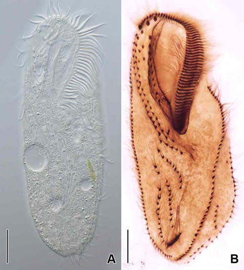 Neobakuella n. sp. in vivo (A) and protargol impregnated specimen (B). A. Typical individual in vivo. B. Ventral view to show oral and ventral somatic ciliature. Scale bars: A, B = 20 μm