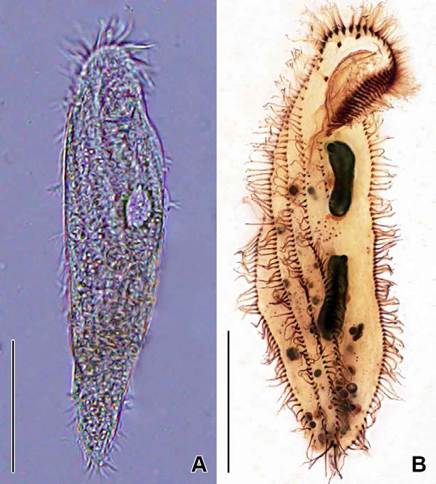 Parabistichella n. sp. in vivo (A) and protargol impregnated specimen (B). A. Typical individual in vivo. B. Ventral view to show oral and ventral somatic ciliature. Scale bars: A, B = 50 μm