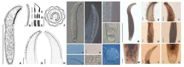 Arcuospathodium cultriforme cultriforme from live (A-F, I-G) and after protargol impregnation (G,H, R-X). A, I, R. Body shape, in vivo and after protargol impregnation. B, J. Extrusome pattern on oral bulge. C, N. Extruded extrusomes. D, O, P, W-X. Extrusome shape and type. E, M. Cortical granule pattern. F, O. Cyst shape. G, H, S, T. Somatic kinety pattern. K. Dorsal brush shape. L. Contractile vacuole. U, V. Macronucleus pattern. Scale bars in A, I, R = 100㎛; F, Q = 20㎛; G, H, L, S-V = 10㎛; B-E, J, K, M-P, W-X = 5㎛