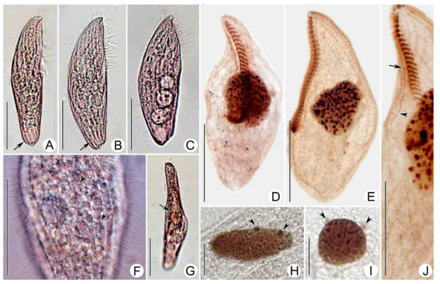 (A–J) Photomicrographs of Blepharisma bimicronucleatum from life (A–C, F, G) and after protargol staining (D, E, H–J). A–C: General views of various individuals in vivo, arrows indicate contractile vacuoles. D: right view of typical individual. E: Left side view of ciliature. F: Cortical granulation and cell surface, arrowheads show cortical granules. G: Ventral view to show paroral membrane (arrow) and oral cavity. H, I: Two micronuclei (arrowheads) attached to the macronucleus. J: Oral ciliature and part of somatic ciliature, arrow indicates paroral membrane, arrowhead denotes zigzag arrangement of the dikinetidal part of the paroral membrane. Scale bars 50 μm (A–G, J), 10 μm (H, I)