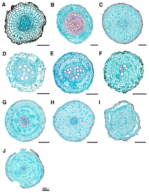 국화과 식물 뿌리 횡단면 전체 구조. A. 쑥; B. 갯쑥부쟁이; C. 삽주; D. 미국가막사리; E. 담배풀; F. 엉겅퀴; G. 갯씀바귀; H. 솜나물; I. 민박쥐나물; J. 민들레