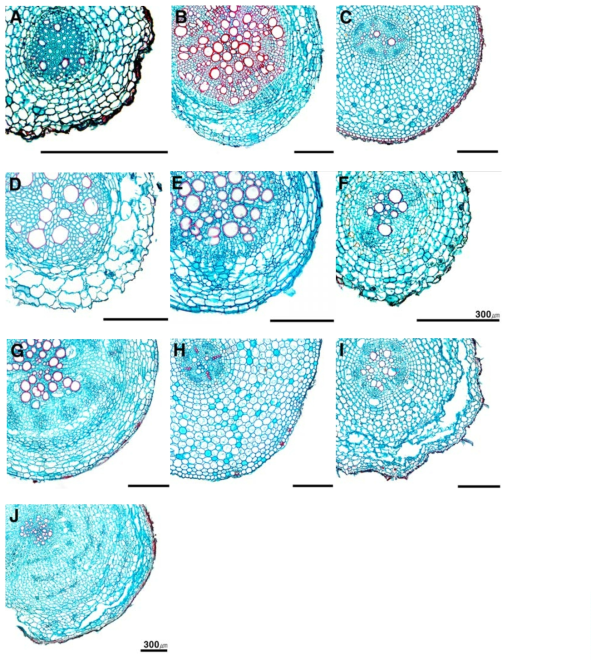 국화과 식물 뿌리 횡단면 확대 구조. A. 쑥; B. 갯쑥부쟁이; C. 삽주; D. 미국가막사리; E. 담배풀; F. 엉겅퀴; G. 갯씀바귀; H. 솜나물; I. 민박쥐나물; J. 민들레