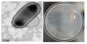 방사선 내성 Methylobacterium 속 발굴종 17Sr1-43의 전자현미경과 배양체 사진