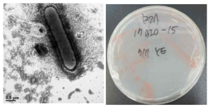 방사선 내성 Hymenobacter 속 발굴종 17Bio_15의 전자현미경과 배양체 사진