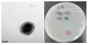 방사선 내성 Hymenobacter 속 발굴종 17gy_33의 전자현미경과 배양체 사진