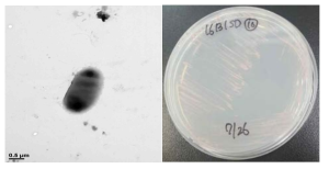 방사선 내성 Methylobacterium 속 발굴종 16B15D의 전자현미경과 배양체 사진