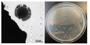 방사선 내성 Deinococcus 속 발굴종 strain8의 전자현미경과 배양체 사진