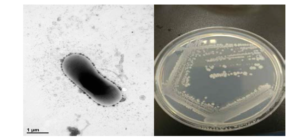 방사선 내성 Bacillus 속 발굴종 17J80-6의 전자현미경과 배양체 사진