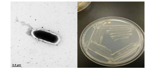방사선 내성 Rhodococcus 속 발굴종 17G22-9 의 전자현미경과 배양체 사진