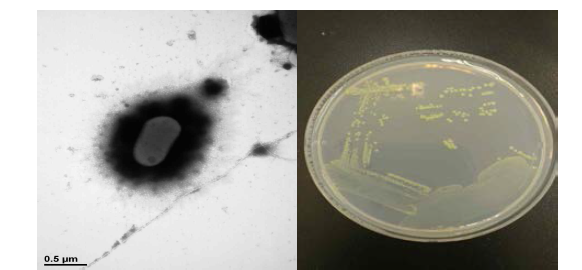 방사선 내성 Pseudarthrobacter 속 발굴종 17G9-4의 전자현미경과 배양체 사진