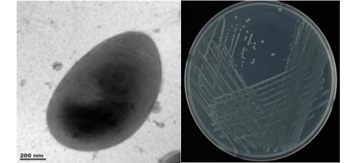 이탄층 Pseudomonas속 발굴종 R-1-8의 전자현미경과 배양체 사진