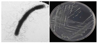 이탄층 Arthrobacter속 발굴종 A-3-6의 전자현미경과 배양체 사진
